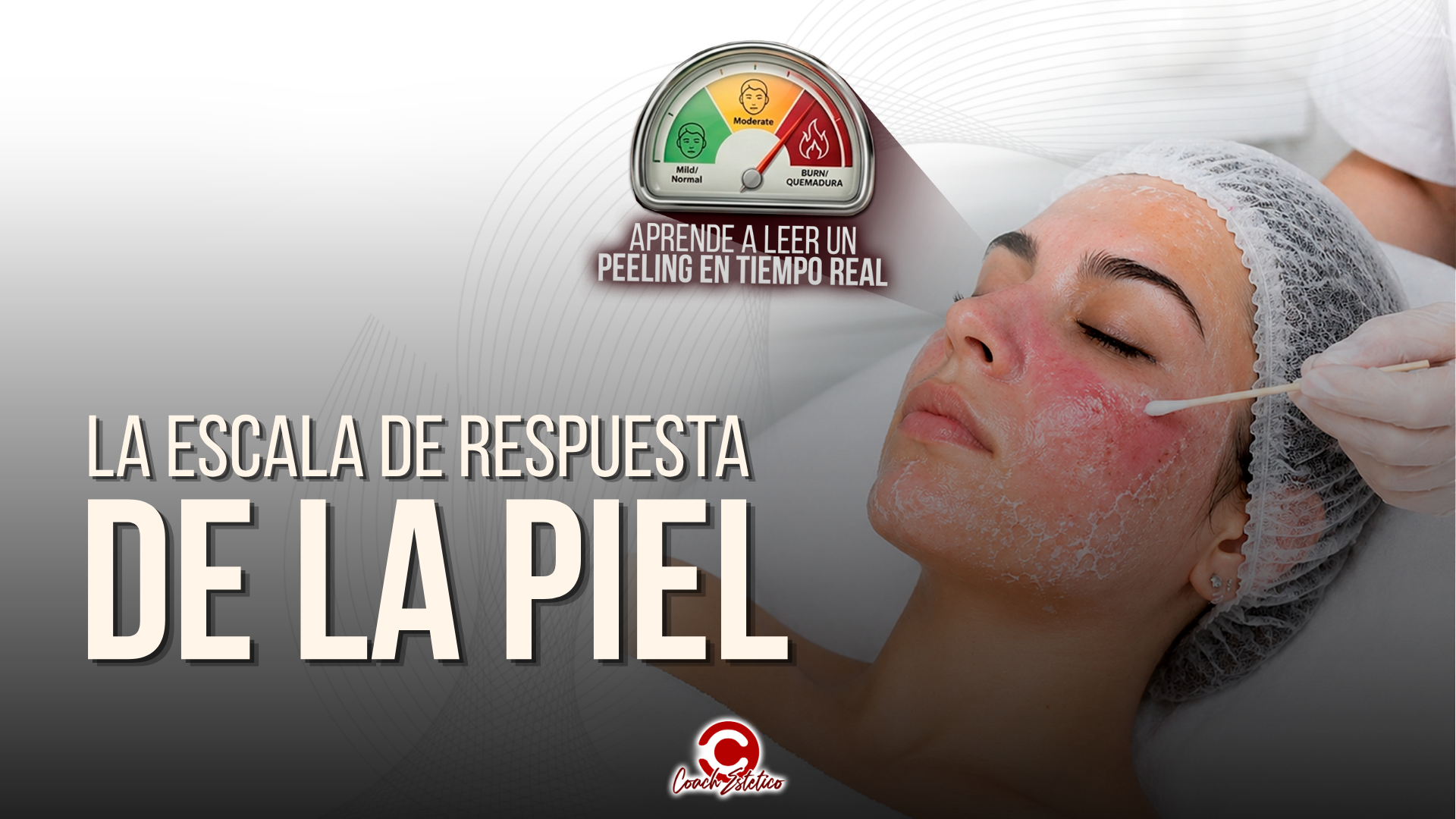 Portada módulo 00 · La Escala de Respuesta de la Piel